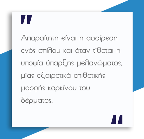 Σπίλοι - Πότε πρέπει να αφαιρούνται;